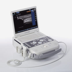 Siemens Acuson P300 + Transd. Convexo