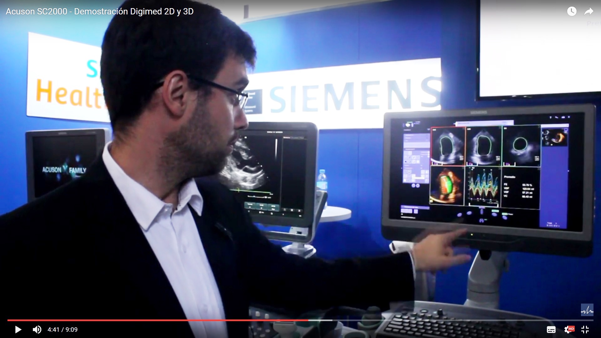 Acuson SC2000 – Demostración Digimed 2D y 3D