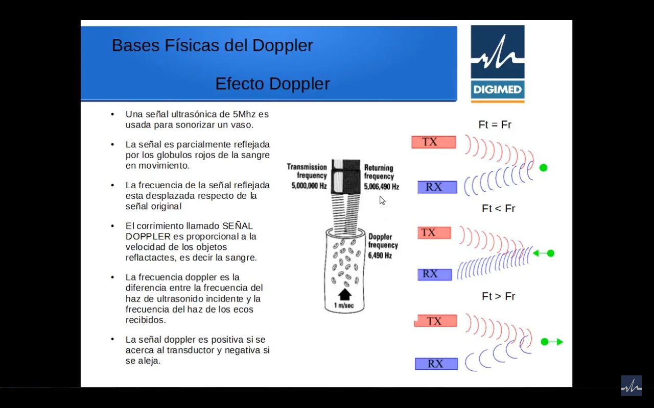 Física del Doppler – parte 3º