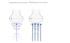 MultiBeam