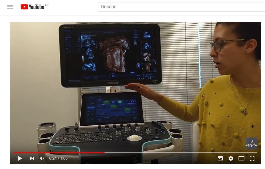 Novedades en inteligencia artificial aplicada al diagnóstico por ultrasonido