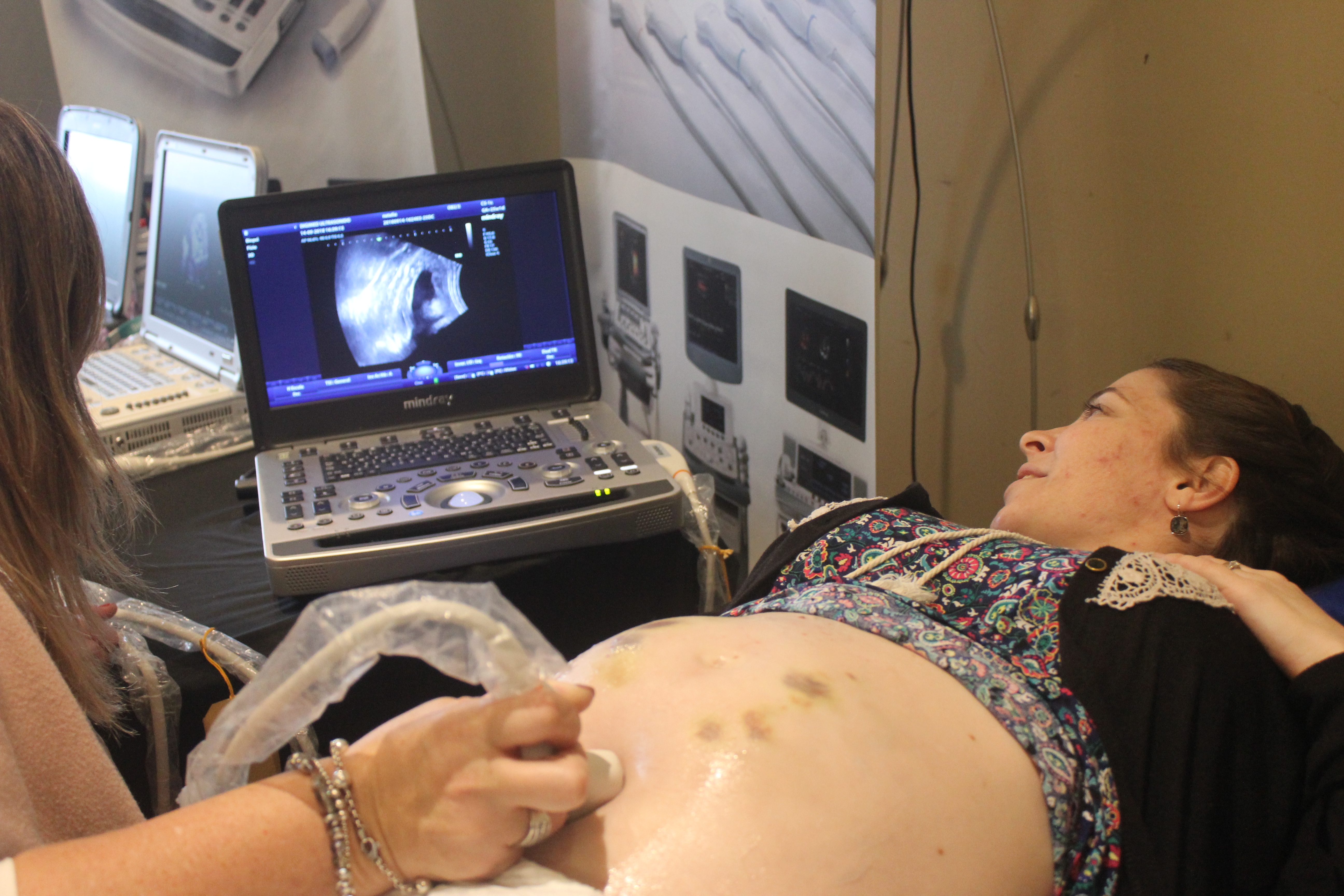 Simposio Argentino de Cardiología Fetal en Santa Fe