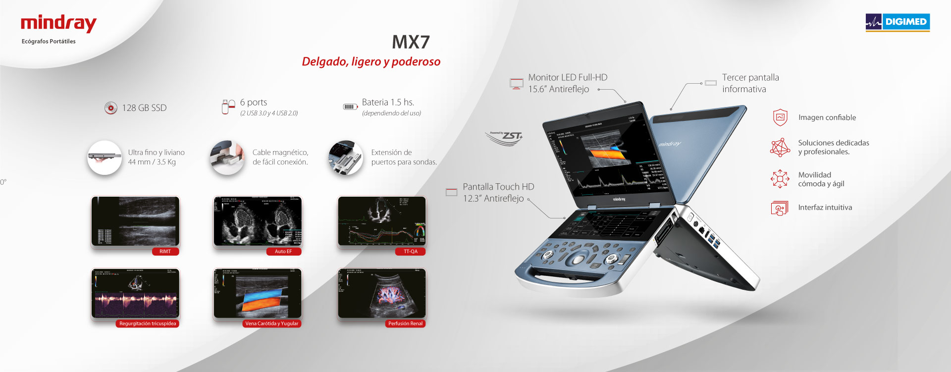 Mindray MX7