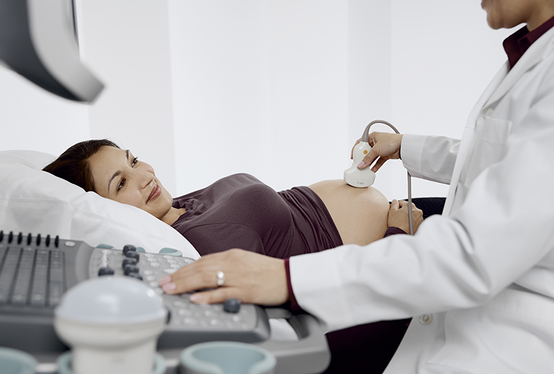 Siemens Acuson X300PE