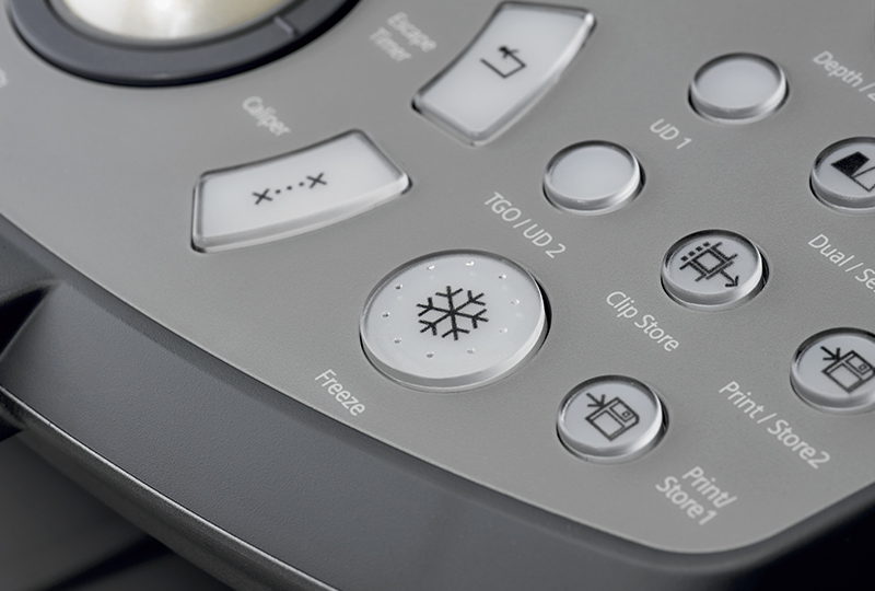 Siemens Acuson X300PE