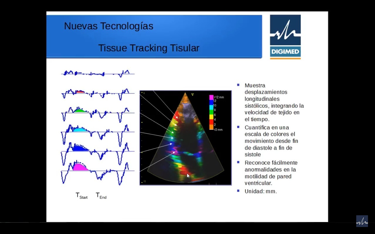 Nuevas tecnologías en Ecocardiografía – parte 4º