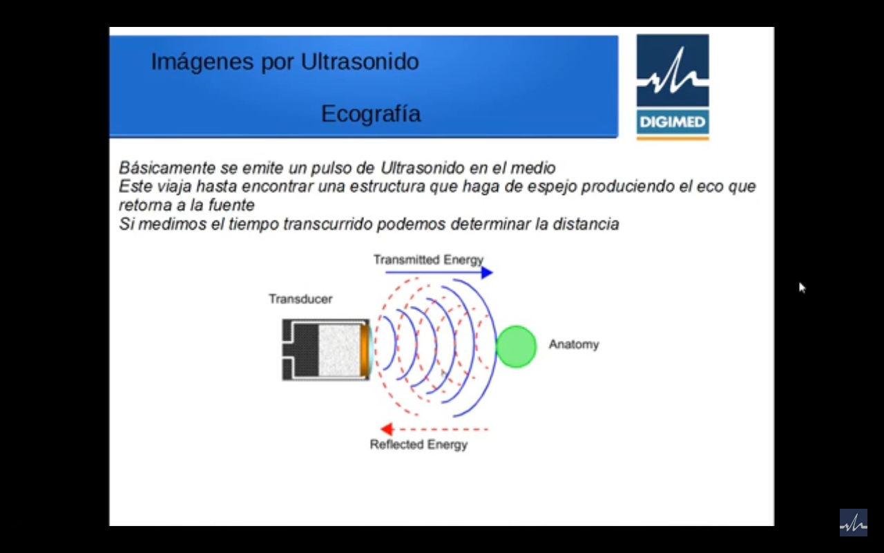 Imagen 2D y THI – parte 2º