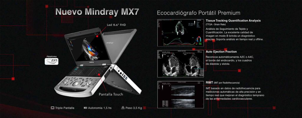 Mindray MX7