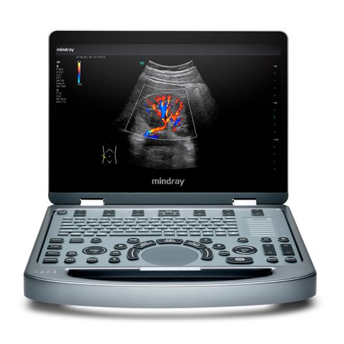 Mindray MX5 ¡Nuevo! – Digimed