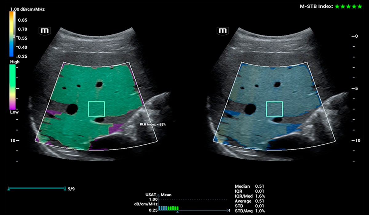 Resona I9 Elite Edition