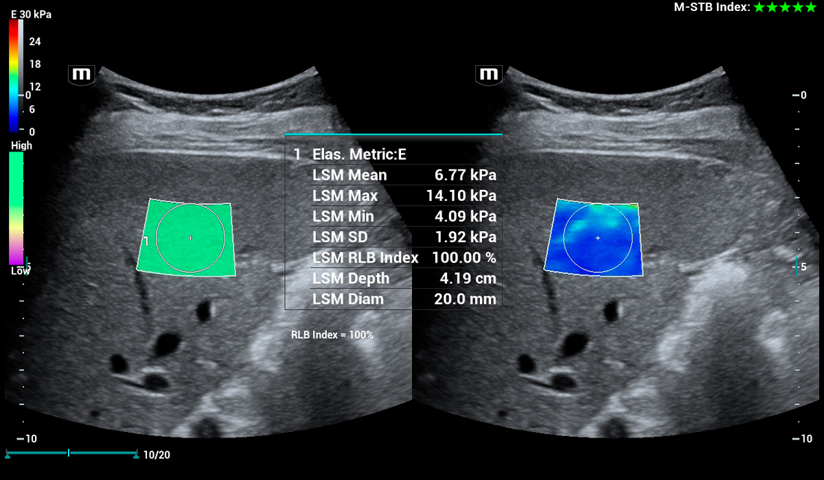 Resona I9 Elite Edition
