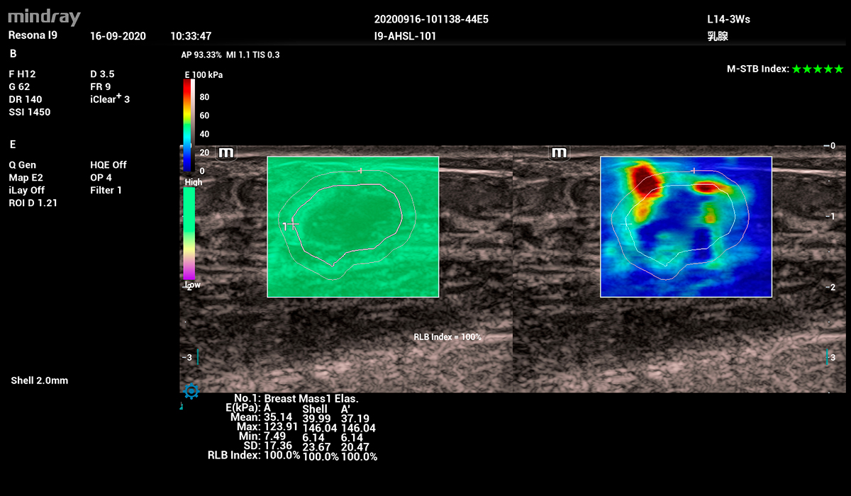 Resona I9 Elite Edition