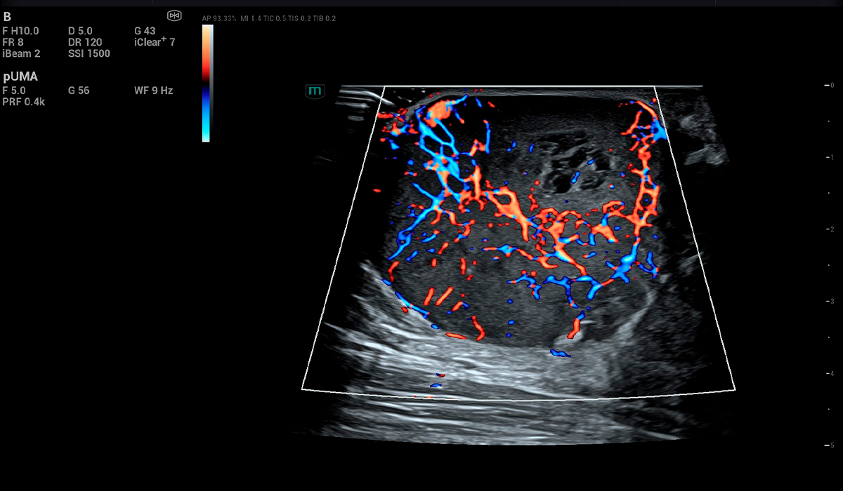 Resona I9 Elite Edition