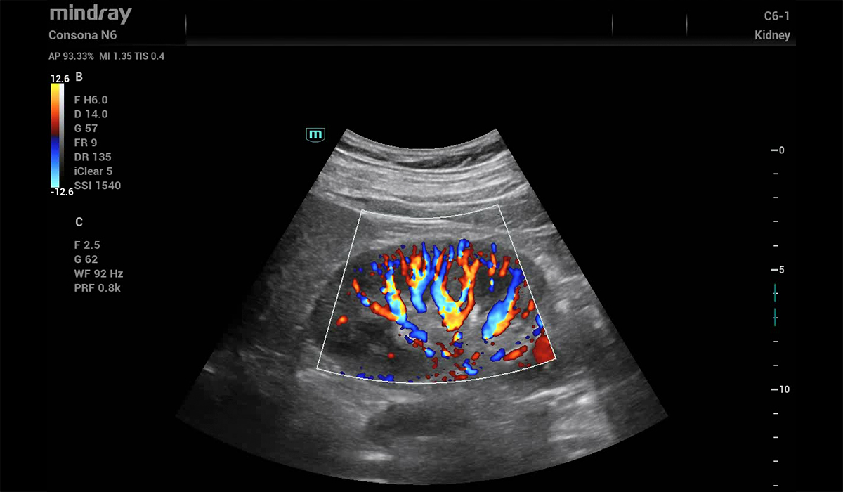 Mindray Consona N6 Pro