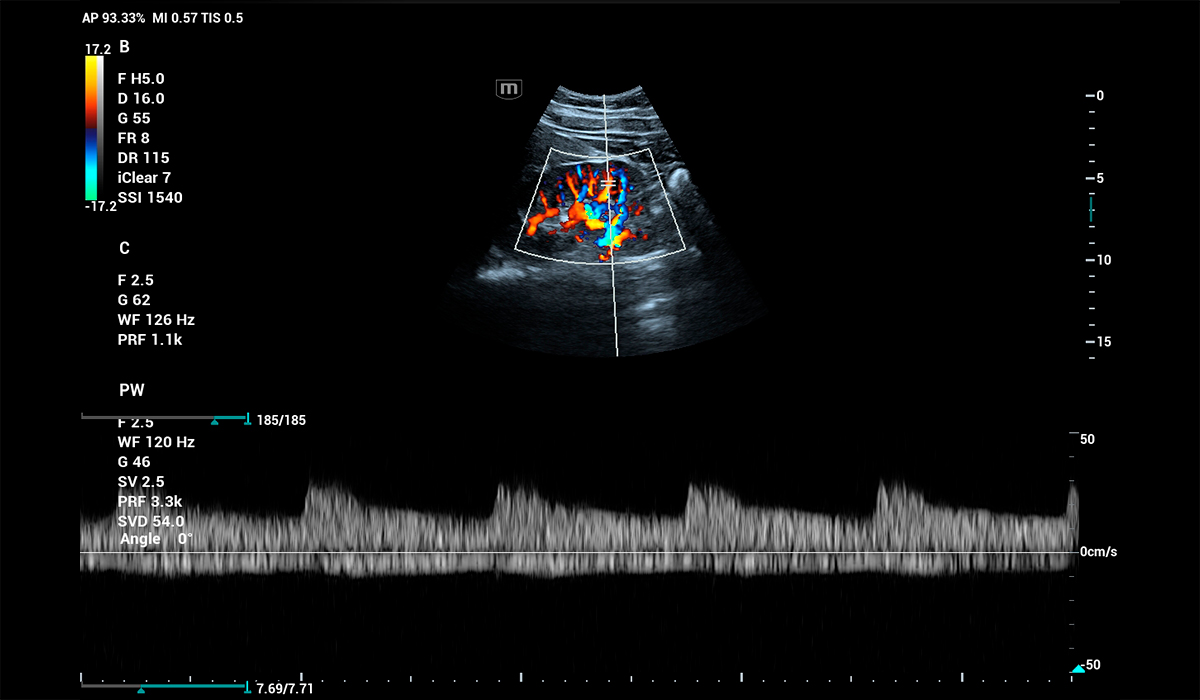 Mindray Consona N6 Pro