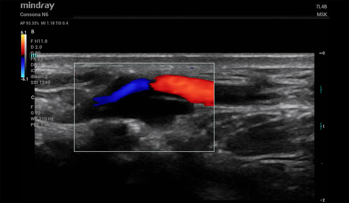 Mindray Consona N6 Pro