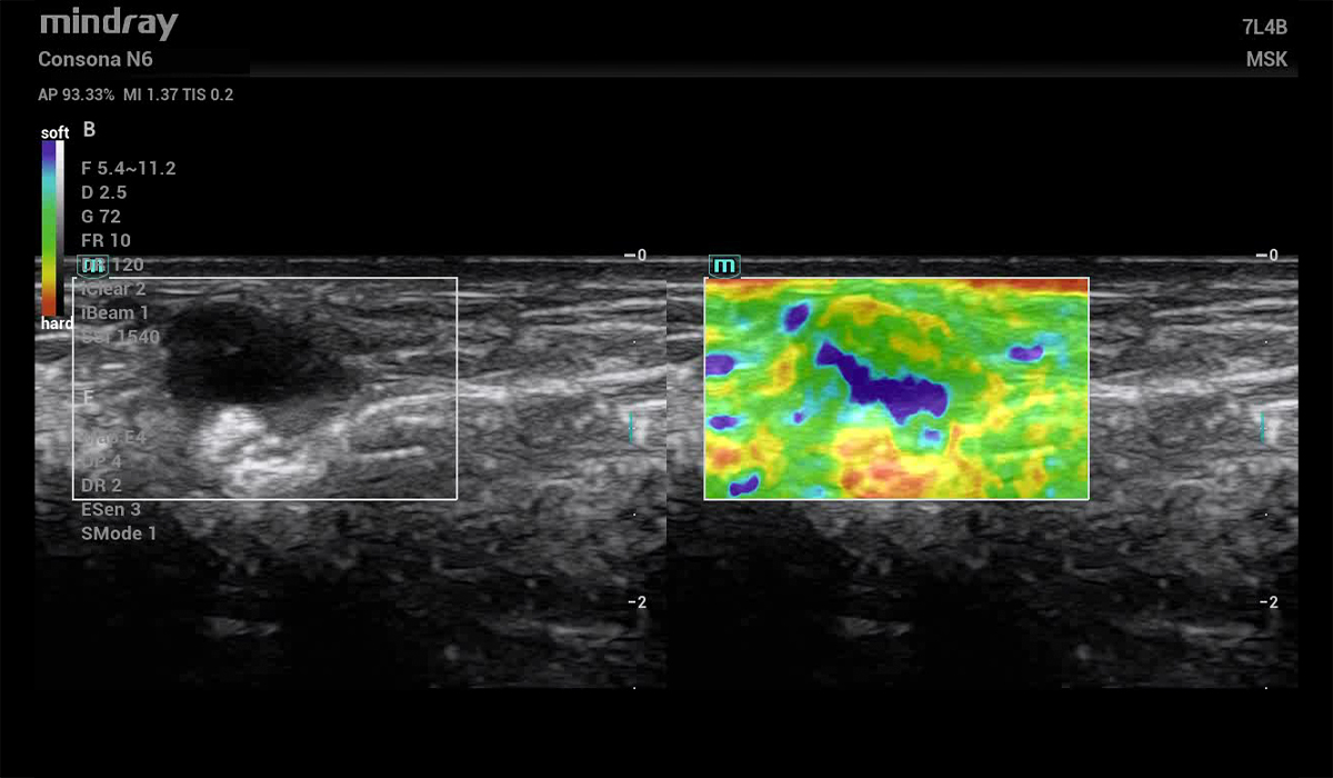 Mindray Consona N6 Pro