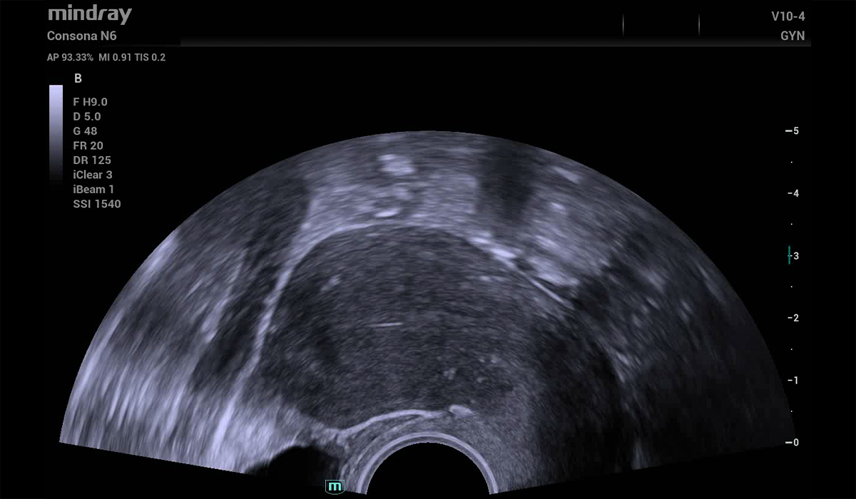 Mindray Consona N6 Pro