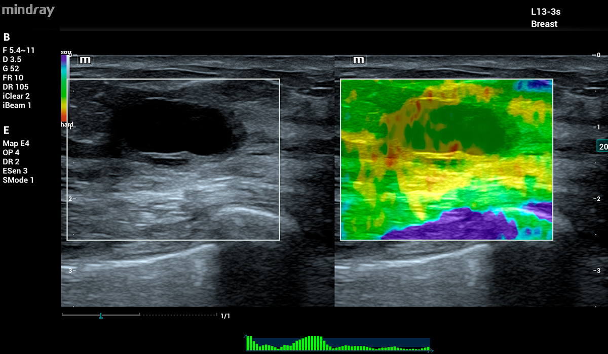 Mindray MX7 Elite Edition