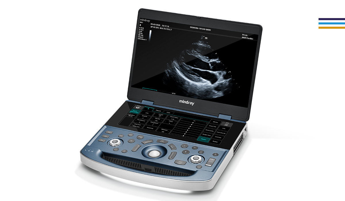 Mindray MX7 Elite Edition