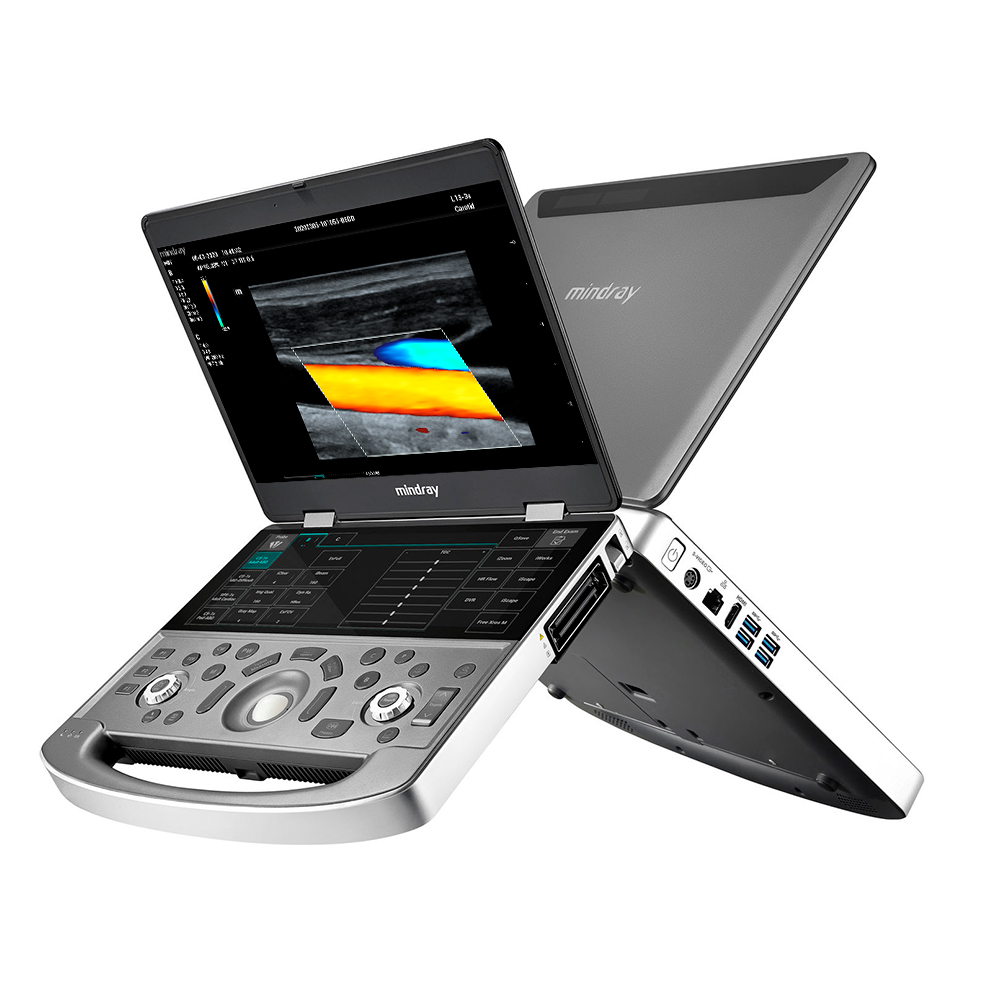 Mindray MX7 Elite Edition Mindray MX7 Elite Edition