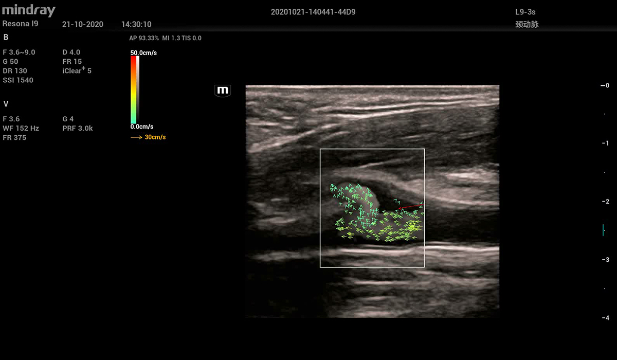Resona I9 Elite Edition