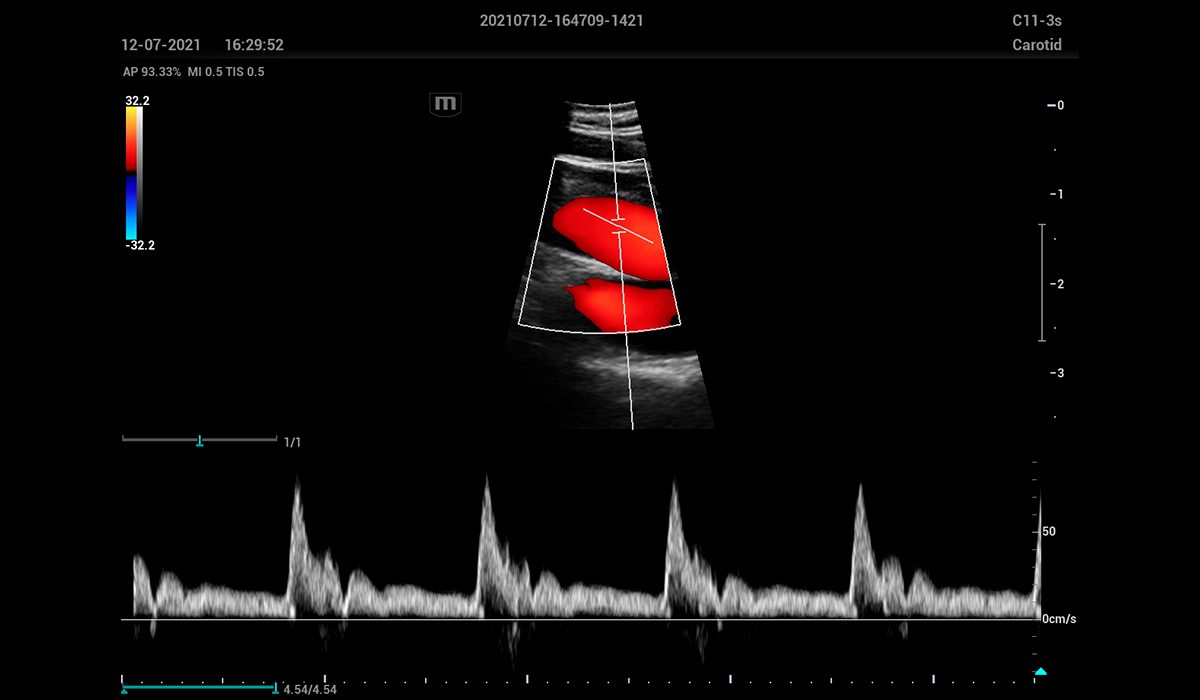 Resona I9 Elite Edition