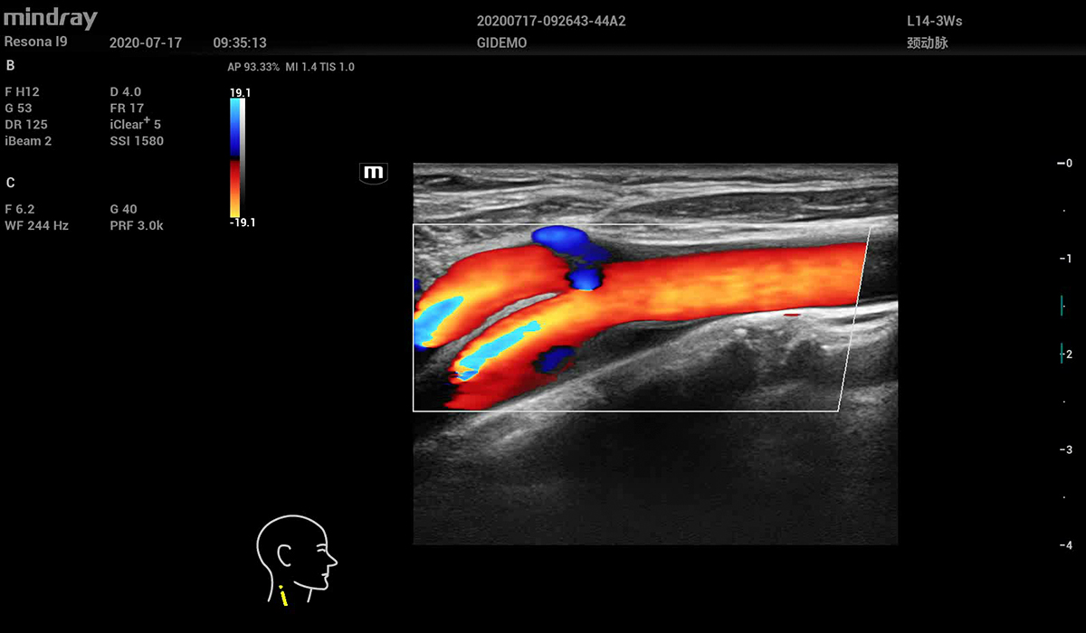 Resona I9 Elite Edition