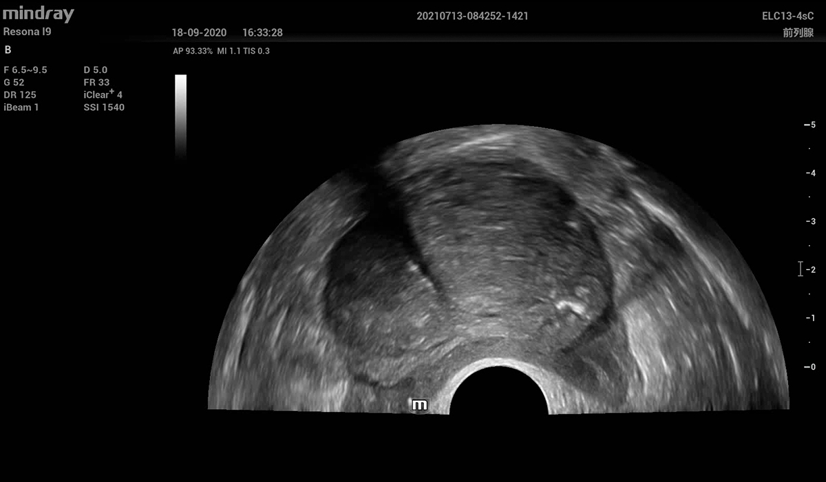 Resona I9 Elite Edition