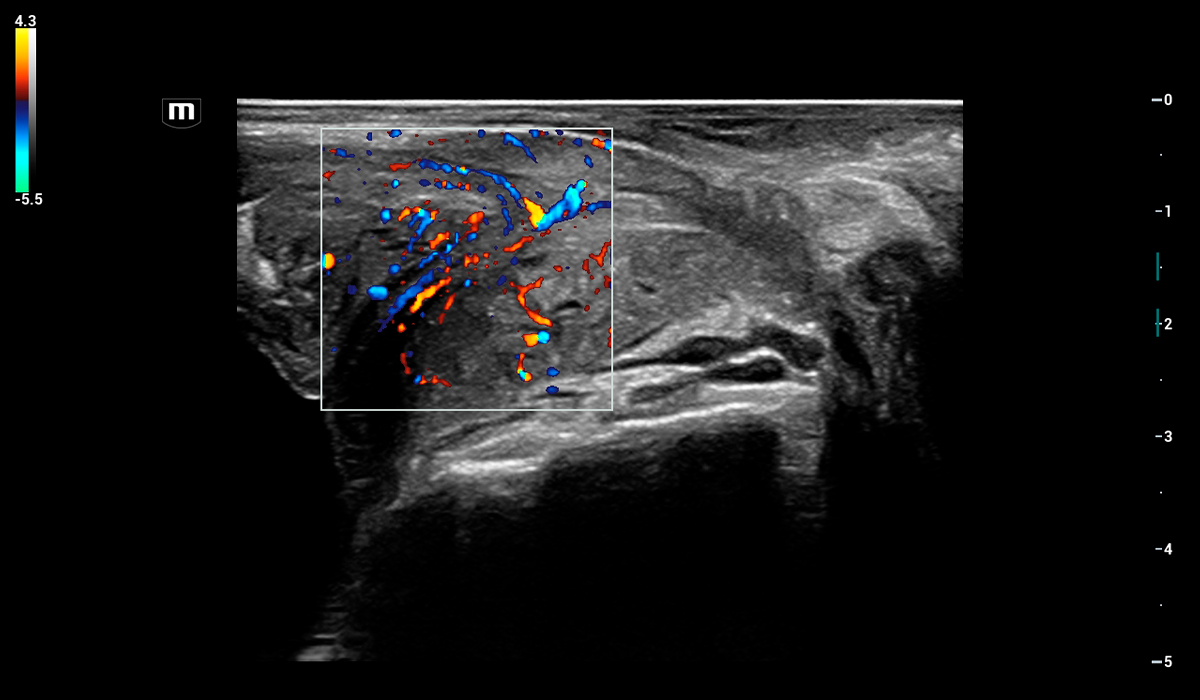 Resona I9 Elite Edition