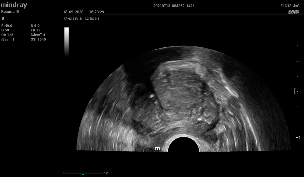 Resona I9 Elite Edition