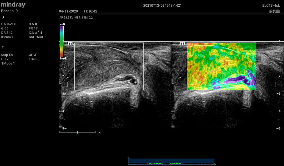 Resona I9 Elite Edition