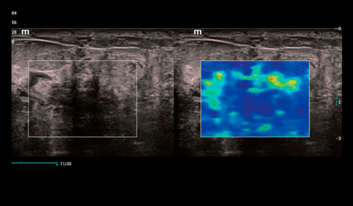 Resona I9 Elite Edition