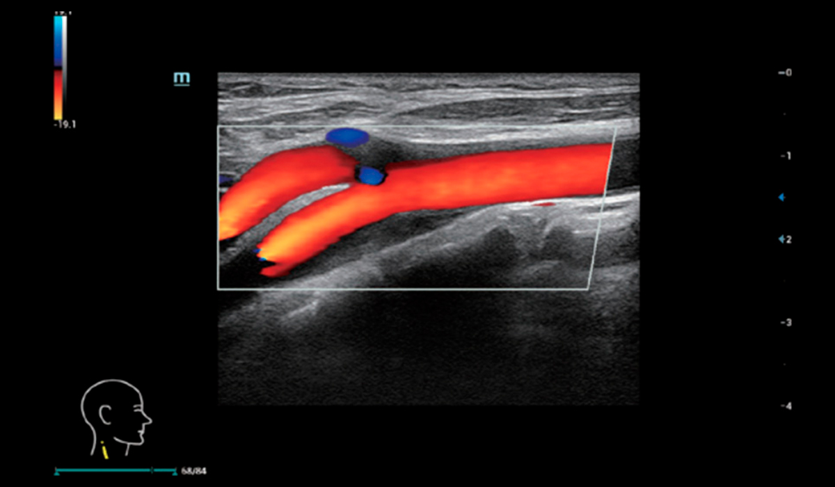 Resona I9 Elite Edition
