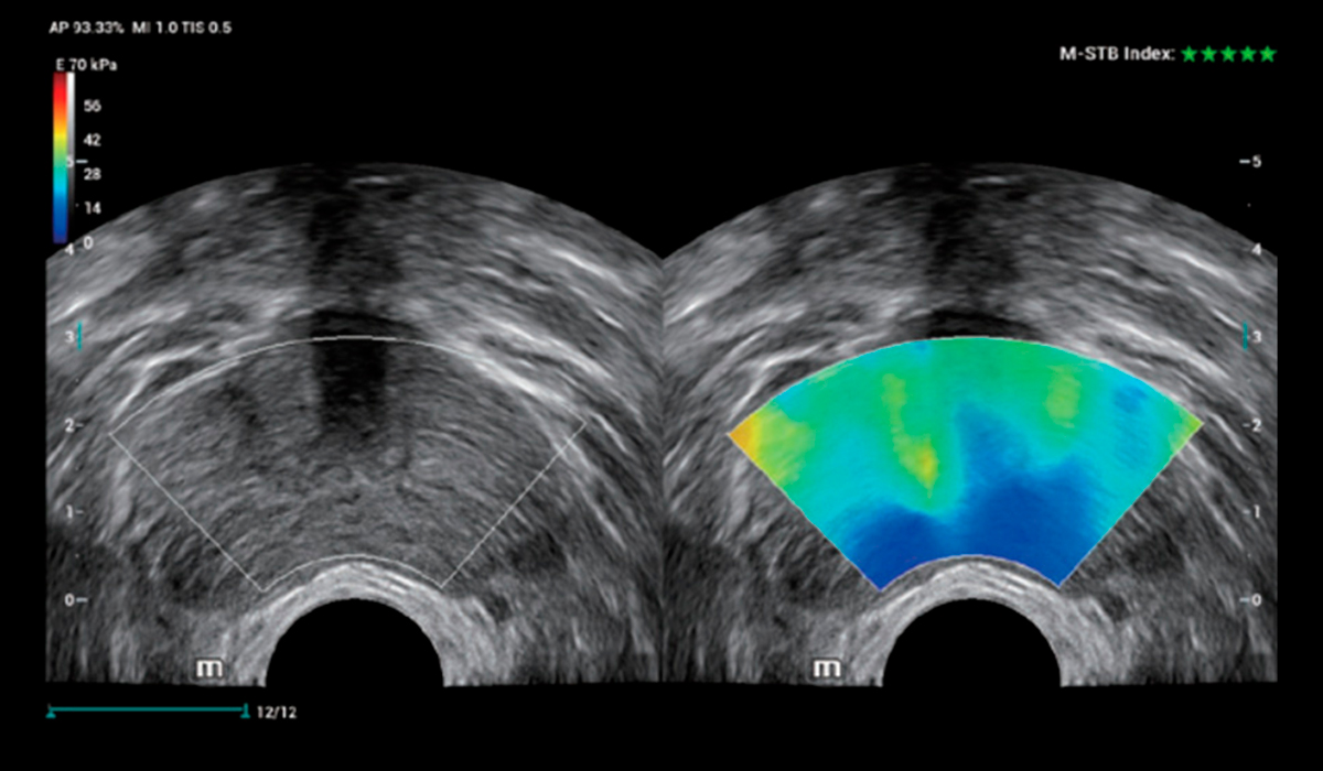 Resona I9 Elite Edition