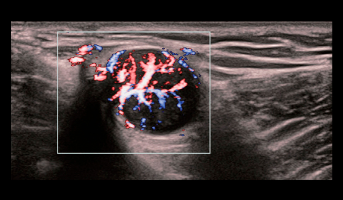 Resona I9 Elite Edition