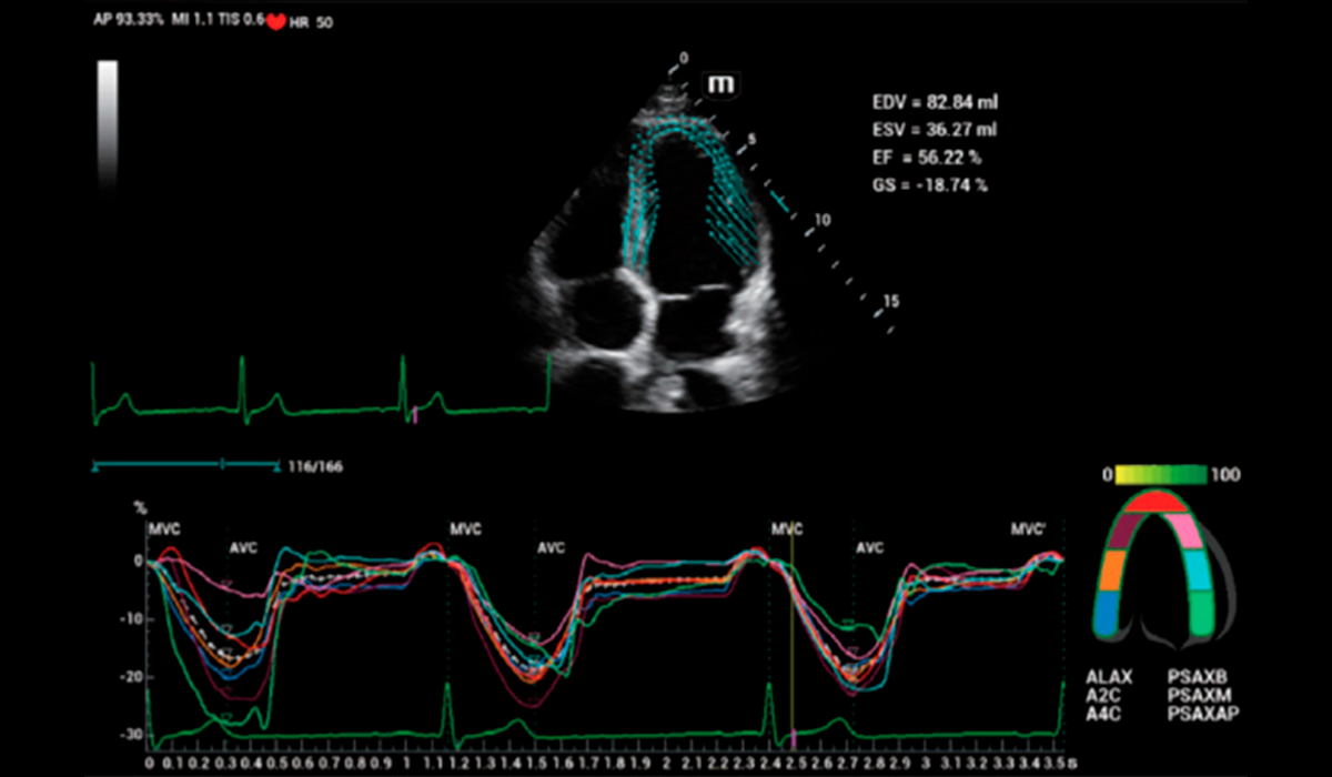 Resona I9 Elite Edition