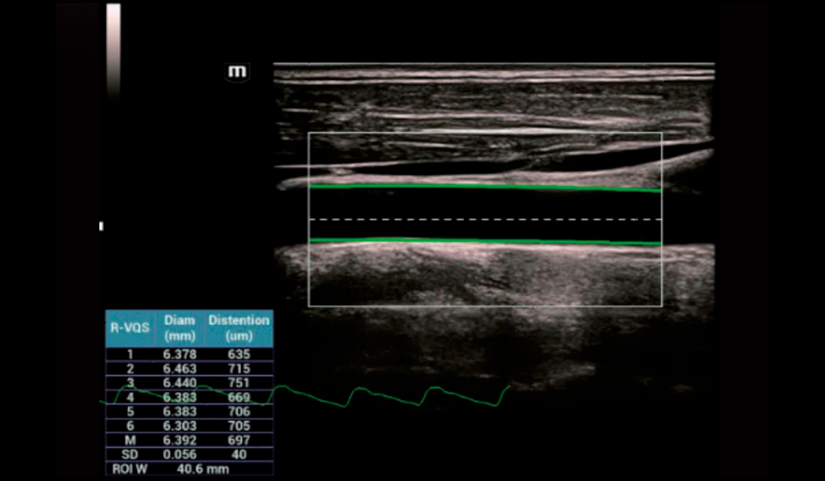 Resona I9 Elite Edition