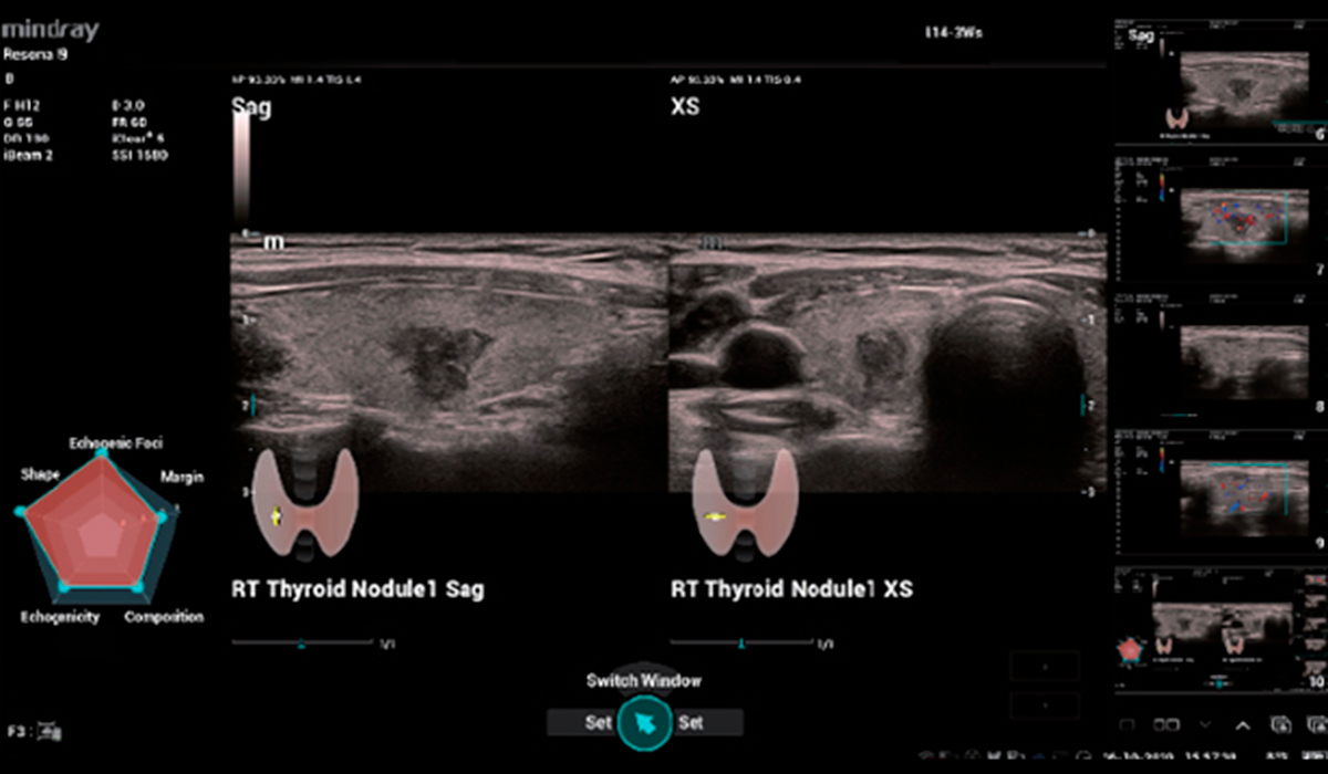 Resona I9 Elite Edition