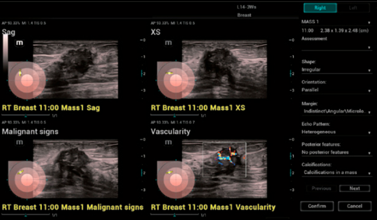 Resona I9 Elite Edition