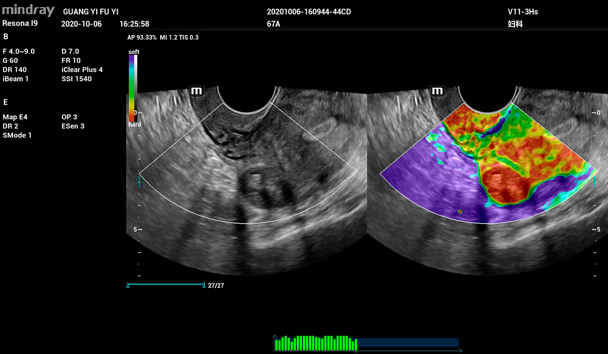 Resona I9 Elite Edition