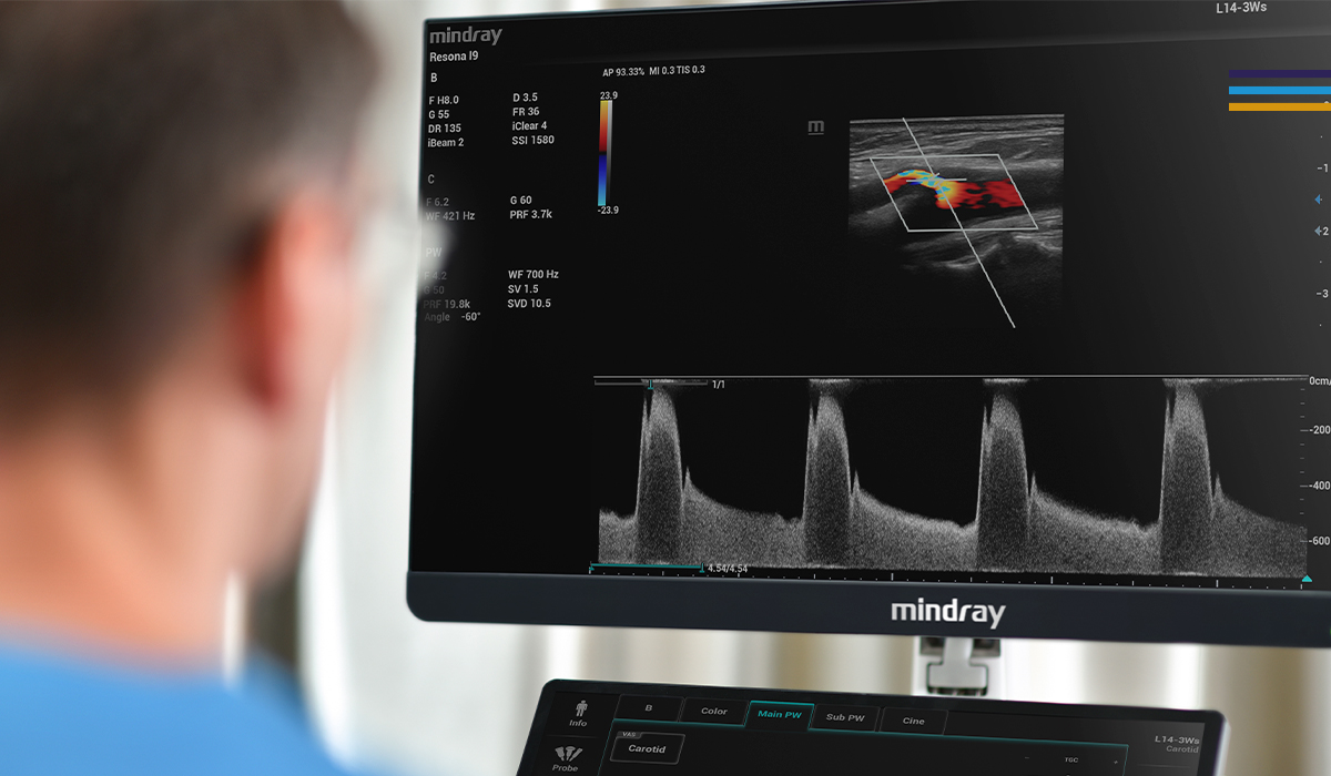 Resona I9 Elite Edition