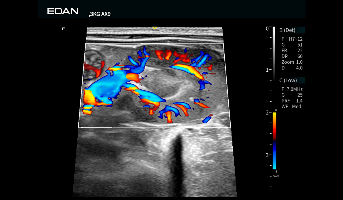 Acclarix AX9 Vet