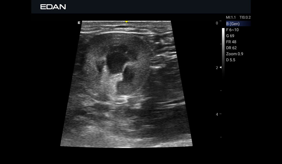 EDAN Acclarix AX3 Vet