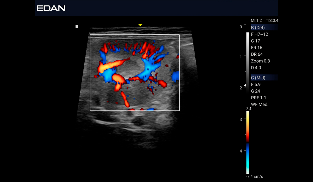EDAN Acclarix AX3 Vet
