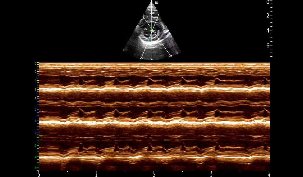 Acclarix AX9 Vet